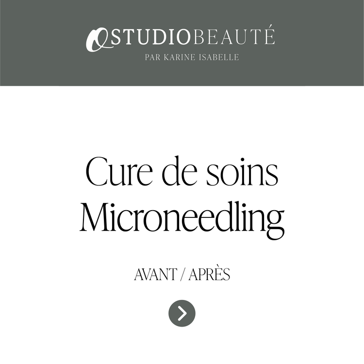 Cure de soins - Microneedling