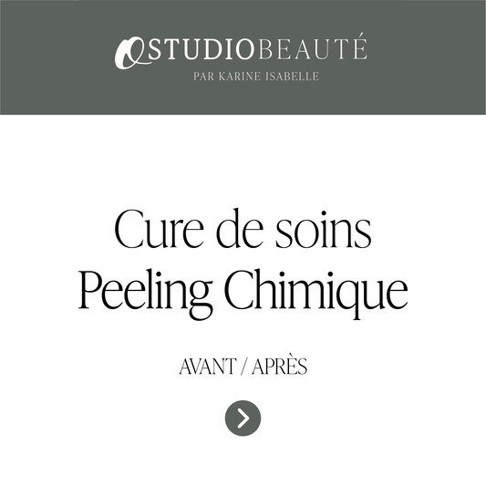 Cure de soins - Peeling Chimique